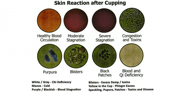 skin reaction2